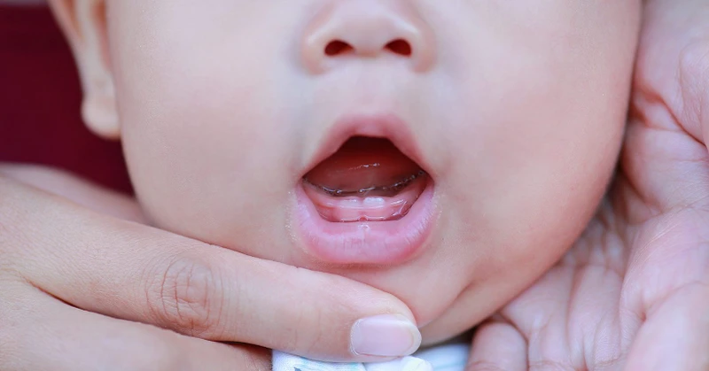 Trẻ trong giai đoạn mọc răng trở nên nhạy cảm hơn với các tác nhân gây nhiễm trùng dẫn đến hiện tượng sốt