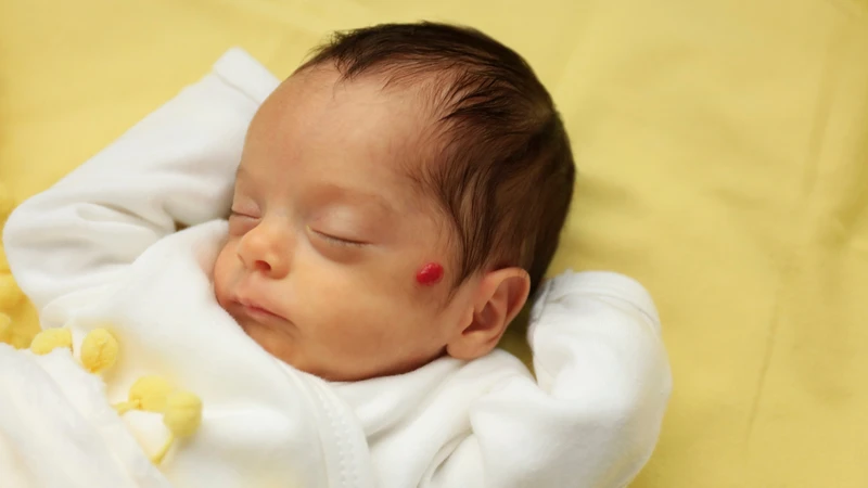 Theo dõi u máu giúp phát hiện thay đổi bất thường