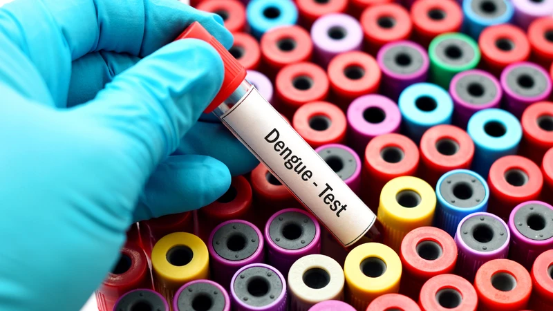 Cách test sốt xuất huyết tại nhà chính xác 2