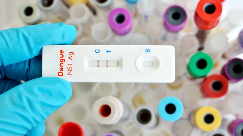 Cách test sốt xuất huyết tại nhà chính xác 1