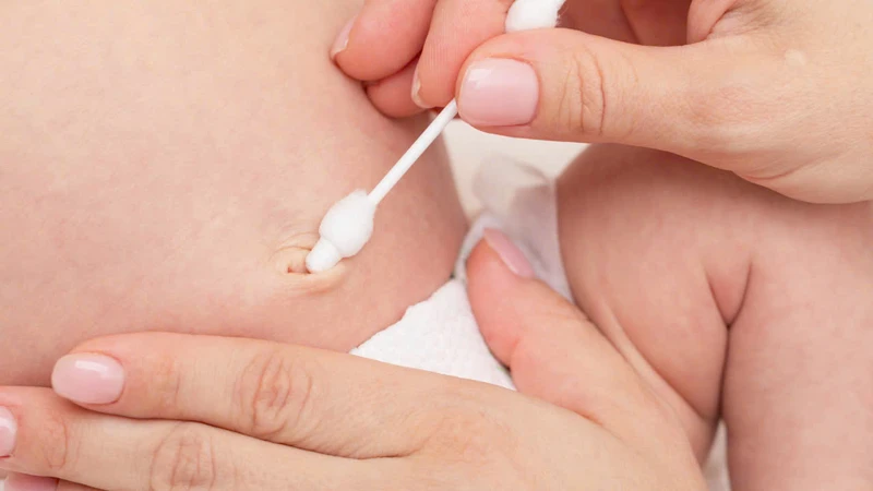 Cách tháo kẹp rốn cho trẻ sơ sinh đúng cách, an toàn cha mẹ có thể tham khảo 3