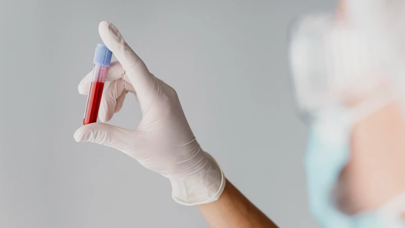 Xét nghiệm máu giúp đánh giá tình trạng miễn dịch với virus thủy đậu