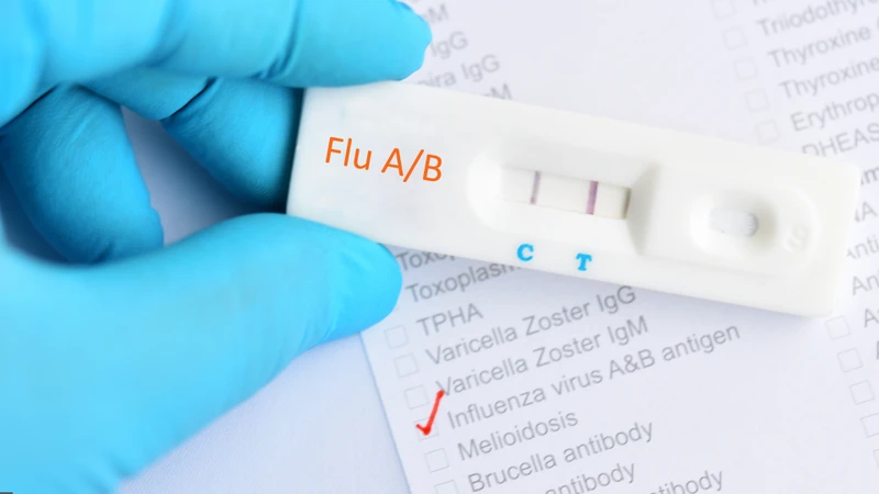 Cảm cúm test nhanh có lên 2 vạch không? Cần lưu ý điều gì? 1