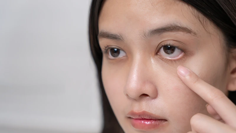Không nên dụi mắt khi cảm thấy ngứa, bởi hành động này có thể khiến tình trạng trở nên nghiêm trọng hơn