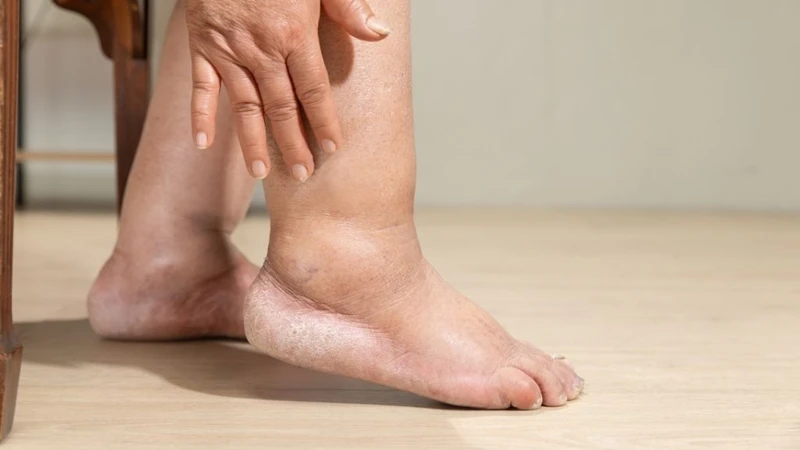 Cảnh báo 9 dấu hiệu ung thư gan giai đoạn cuối 4
