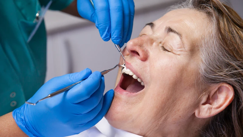 Lấy cao răng siêu âm là phương pháp phổ biến giúp loại bỏ mảng bám cứng trên răng