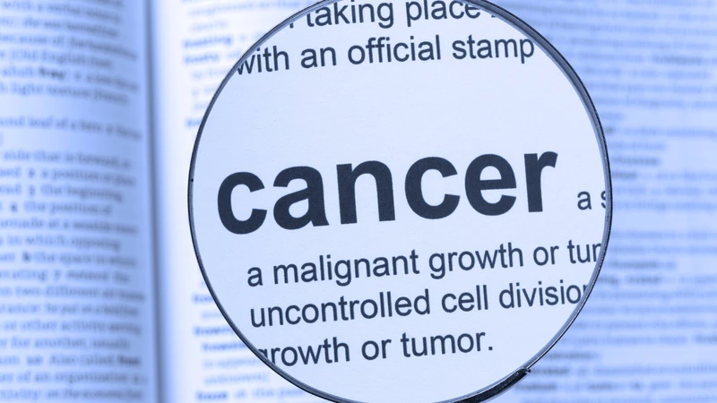 Carcinoma là gì là thắc mắc của nhiều người