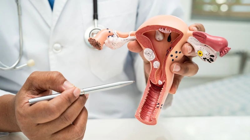 Cắt 1 bên buồng trứng có con được không? Một số lưu ý sau khi cắt 1 bên buồng trứng để bảo vệ khả năng sinh sản 4
