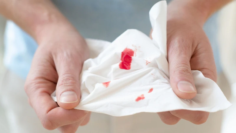 Polyp cổ tử cung gây ra tình trạng ra huyết bất thường có chỉ định cắt bỏ