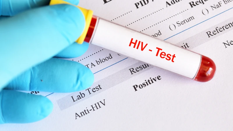 Sàng lọc máu kiểm tra nhiễm HIV
