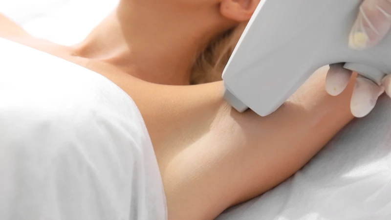 Chăm sóc vết thương đúng cách giảm nguy cơ sẹo lồi sau khi cắt tuyến mồ hôi