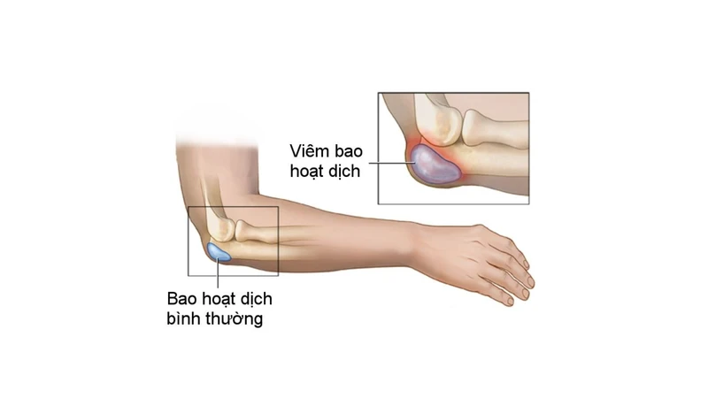 cau-tao-bao-hoat-dich-va-cac-chuc-nang-cua-bao-hoat-dich4.png