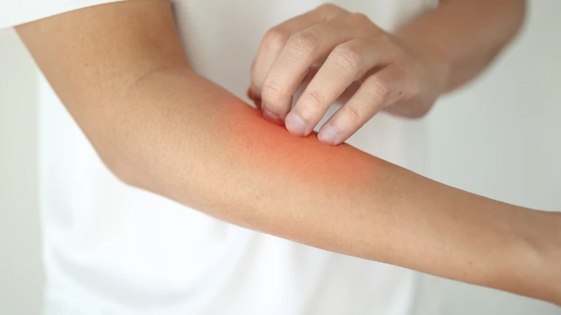 Ngừng sử dụng và đến cơ sở y tế nếu xuất hiện các dấu hiệu bất thường
