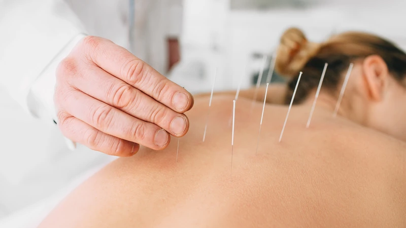 Châm cứu giúp hỗ trợ giảm một số triệu chứng khác