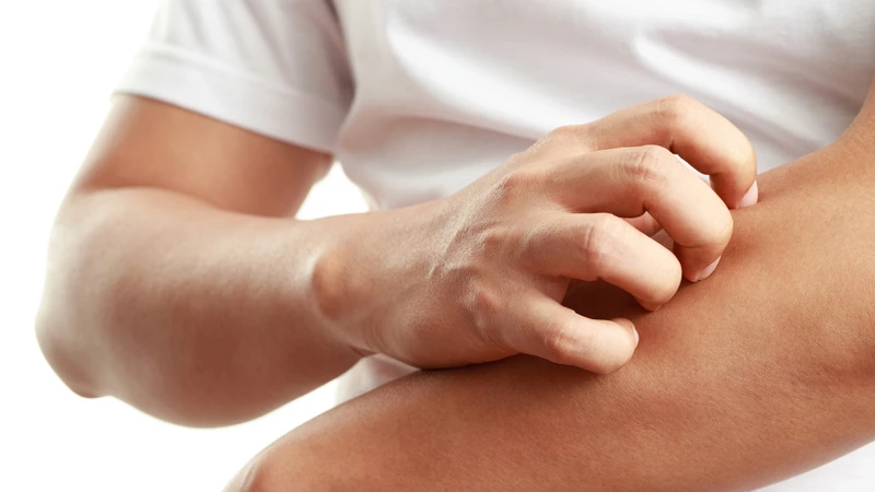 Chăm sóc bệnh nhân xơ gan giai đoạn cuối: Những lưu ý giúp người bệnh ổn định sức khỏe