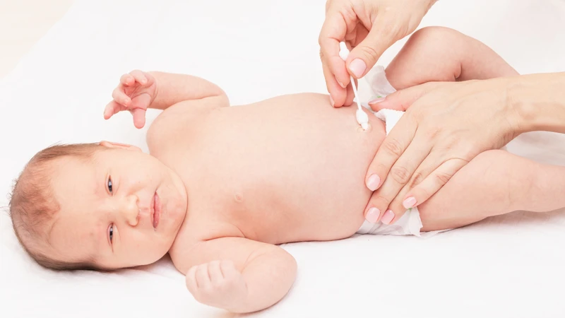 Chăm sóc rốn trẻ sơ sinh như thế nào để tránh nhiễm trùng? 3