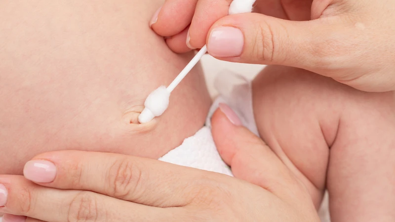 Chăm sóc rốn trẻ sơ sinh như thế nào để tránh nhiễm trùng? 1