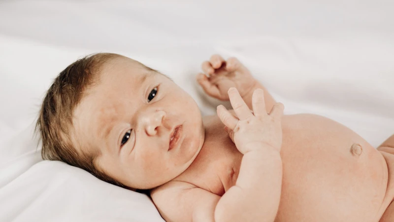 Chàm sữa ở trẻ sơ sinh là gì? Những vấn đề cần biết về chàm sữa sơ sinh 1
