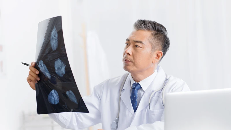 Chẩn đoán hình ảnh là bước quan trọng để xác định mức độ gãy xương sườn số 5 6 7