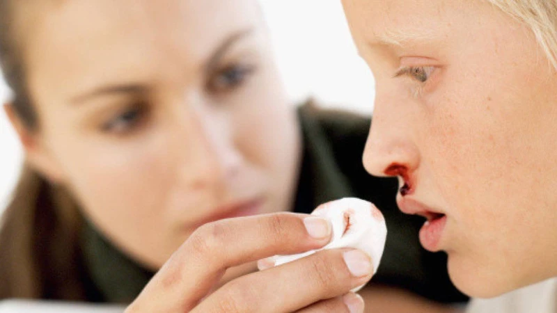 Chảy máu mũi là gì? Nguyên nhân, triệu chứng và cách điều trị 1