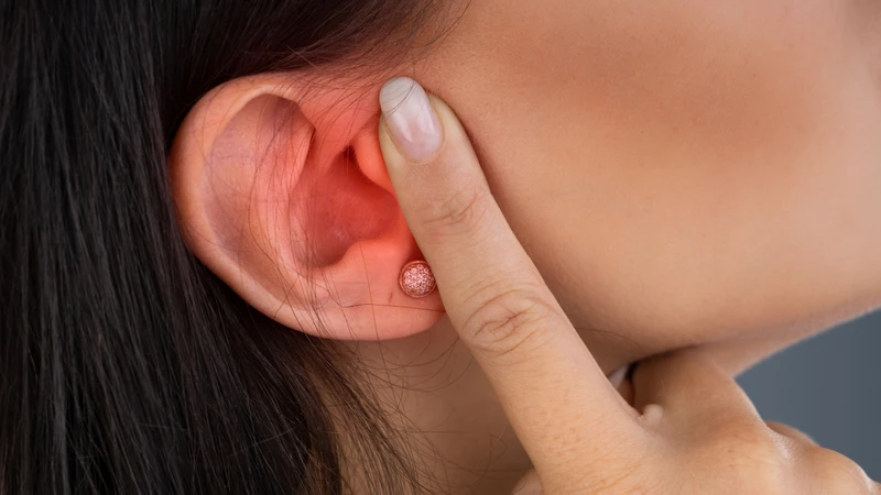 Chảy nước vàng ở vành tai do nhiễm trùng gây viêm mô tế bào