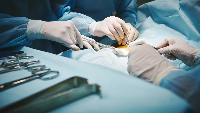 Chi phí mổ khối u lành tính có thể được bảo hiểm y tế chi trả một phần