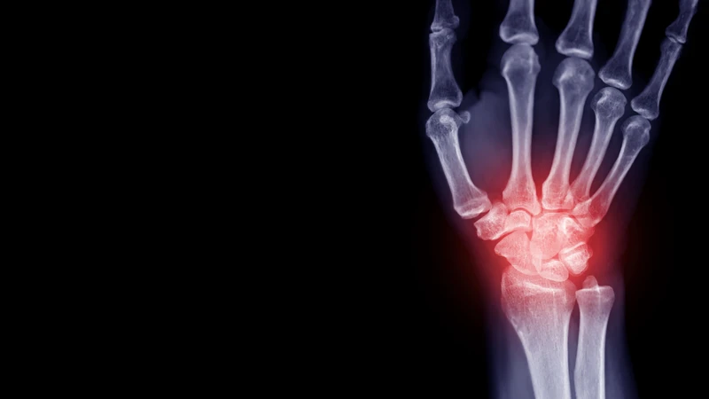 Chi phí còn tuỳ thuộc vào phương pháp phẫu thuật
