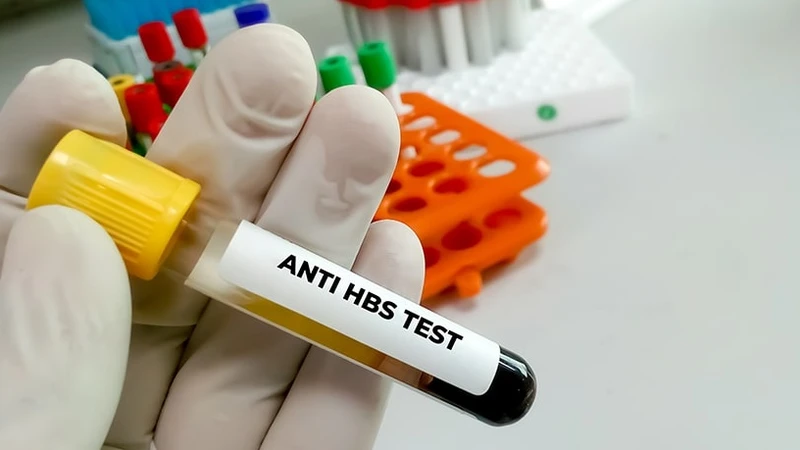 Chỉ số Anti-HBs phản ánh mức độ miễn dịch bảo vệ của cơ thể đối với virus gây bệnh