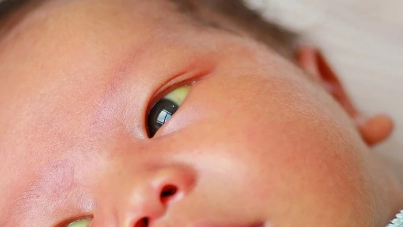 Bilirubin là sắc tố vàng được tạo ra khi hồng cầu bị phân hủy và thường tăng ở trẻ sơ sinh do gan chưa trưởng thành