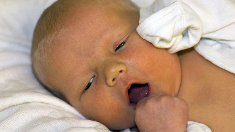 Cha mẹ cần theo dõi sát các dấu hiệu bất thường của trẻ khi bị vàng da