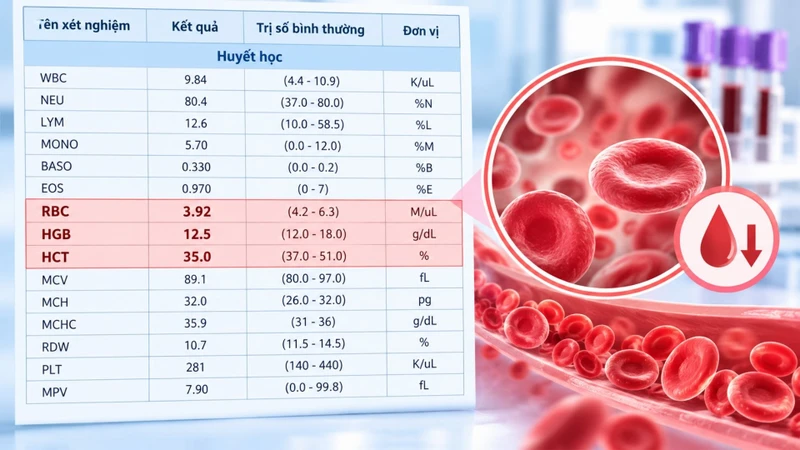 Xét nghiệm công thức máu là bước đầu tiên để đánh giá tình trạng thiếu máu