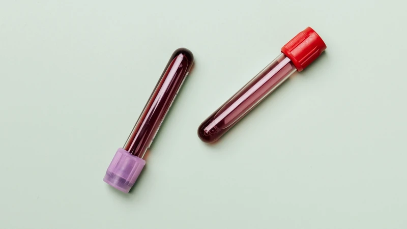 Chỉ số Cyfra 21-1 bình thường trong huyết thanh thường dao động dưới 3,3 ng/mL