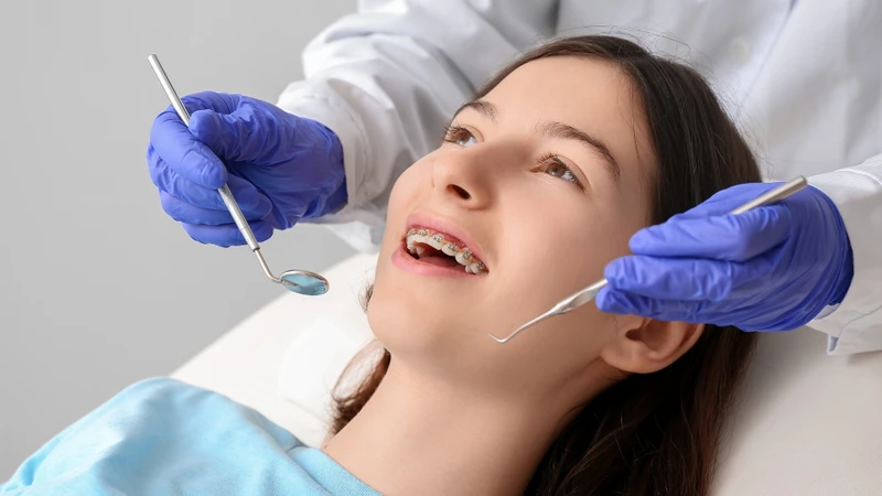 Thời điểm lý tưởng nhất để thực hiện chỉnh nha thường nằm trong khoảng từ 12 - 16 tuổi