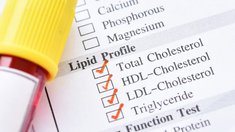 Cholesterol toàn phần bao gồm ba thành phần chính