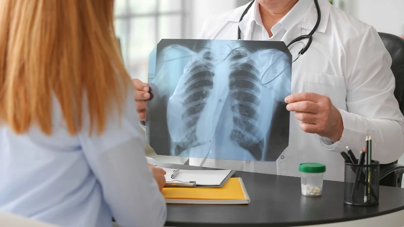 Chữa bệnh lao phổi ở đâu để an toàn và hiệu quả? 2