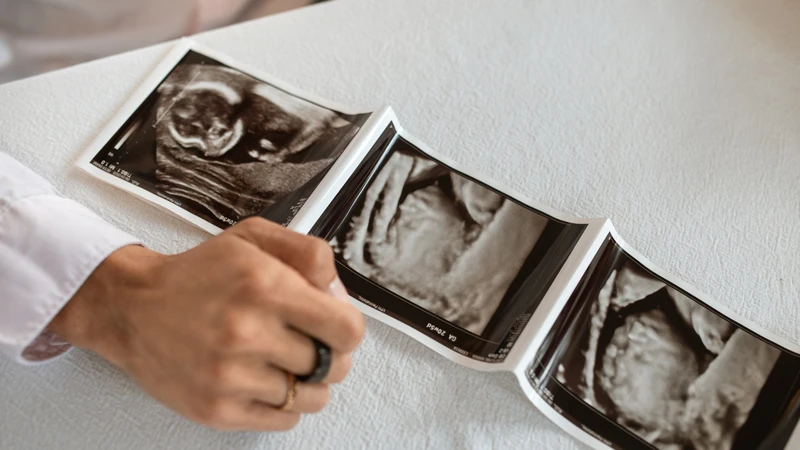 Chửa ngoài tử cung thể huyết tụ thành nang xảy ra khi khối thai ngoài tử cung được bao bọc bởi máu tụ và các mô xung quanh