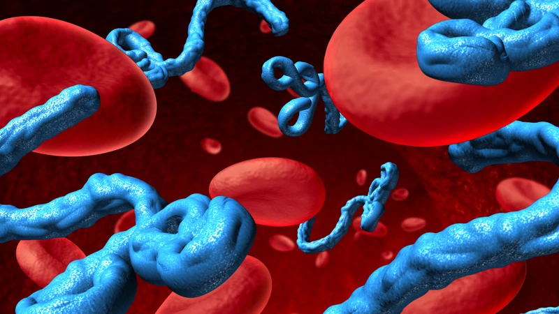Khi bệnh tiến triển nặng hơn, Ebola Bundibugyo có thể gây xuất huyết bất thường