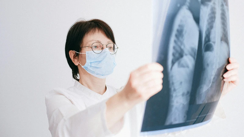 Chụp CT ngực được chỉ định cho những trường hợp nào?4
