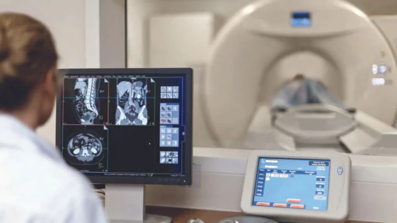 Quy trình chụp CT phổi diễn ra nhanh chóng trong vòng 5 - 15 phút