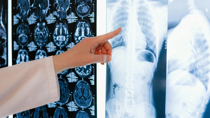 Bác sĩ có thể cân nhắc chỉ định MRI khi kết quả X quang hoặc CT chưa đủ rõ ràng