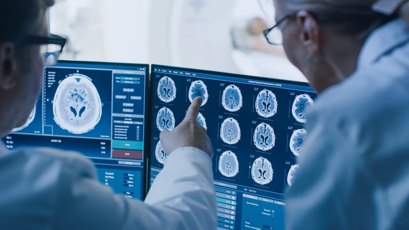 Chụp MRI sọ não có ưu điểm gì? Khi nào cần chụp MRI sọ não?3