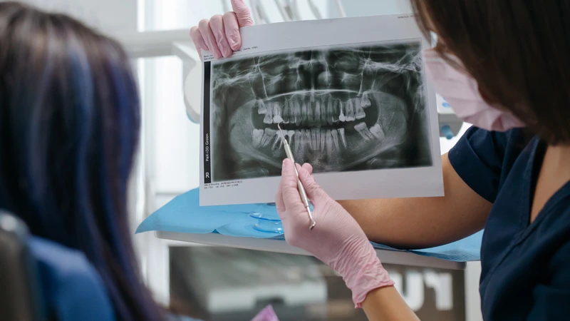 Chụp X-quang răng giúp phát hiện nhiều bất thường khó quan sát trực tiếp
