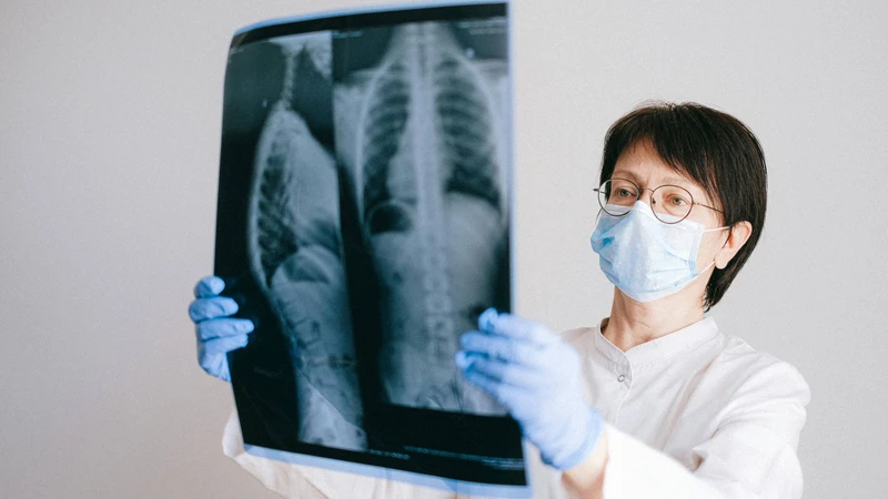 Chụp X quang tràn dịch màng phổi giúp quan sát toàn bộ lồng ngực, hai lá phổi và bóng tim
