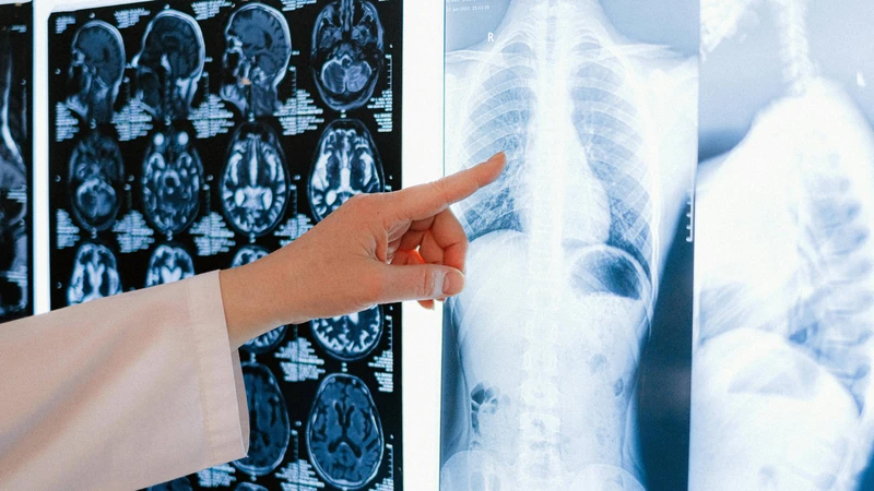 Sau khi có kết quả, bác sĩ sẽ đánh giá hình ảnh phổi để đưa ra hướng điều trị phù hợp