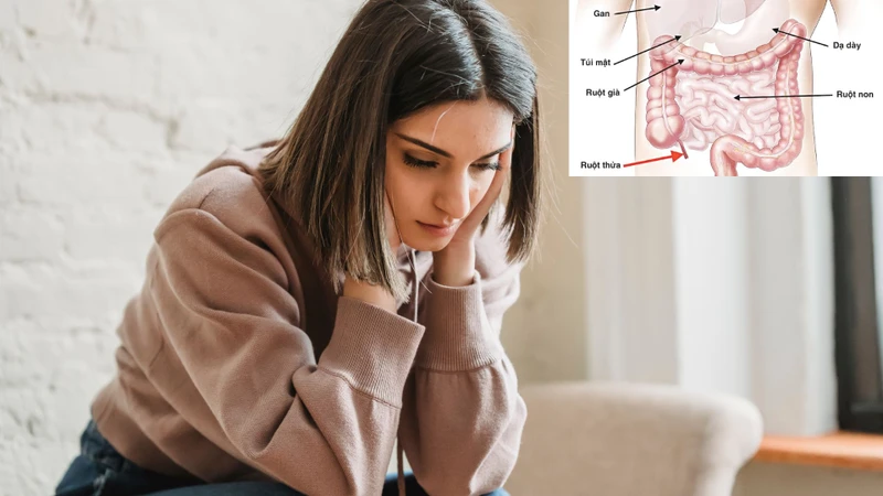 Có nên cắt ruột thừa không là băn khoăn của nhiều độc giả