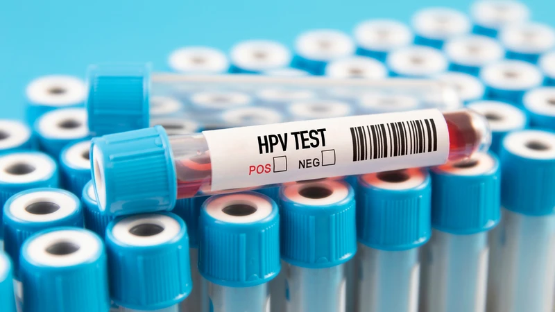 co-nen-kham-sang-loc-truoc-khi-tiem-hpv-hay-khong-2.png