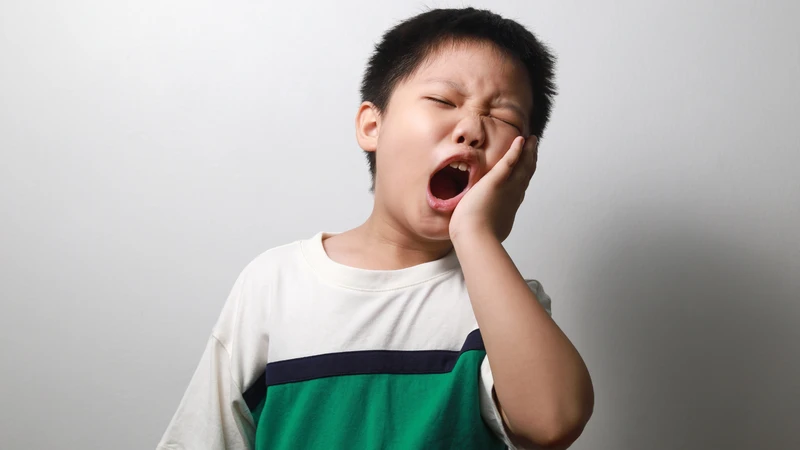 Áp xe chân răng sữa là một chỉ định cần nhổ răng khẩn cấp