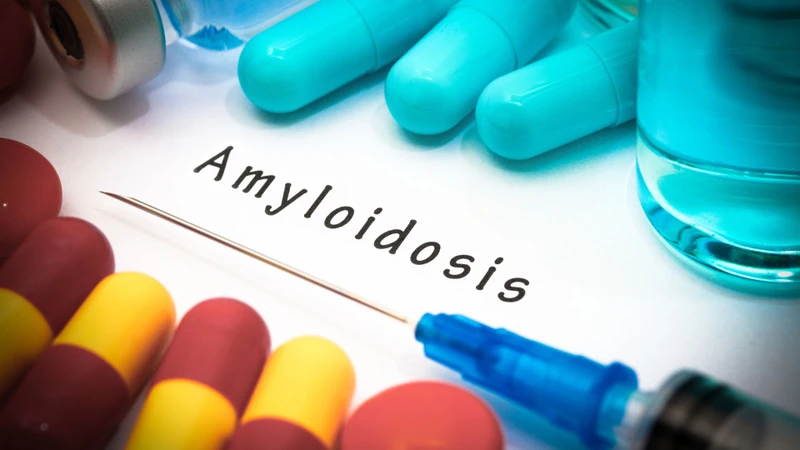 Amyloidosis là bệnh lý xảy ra khi protein bất thường (amyloid) tích tụ trong các mô và cơ quan