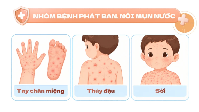 con-di-hoc-mau-giao-nhung-benh-de-lay-trong-lop-nhung-co-the-chu-dong-phong-ngua-6.png
