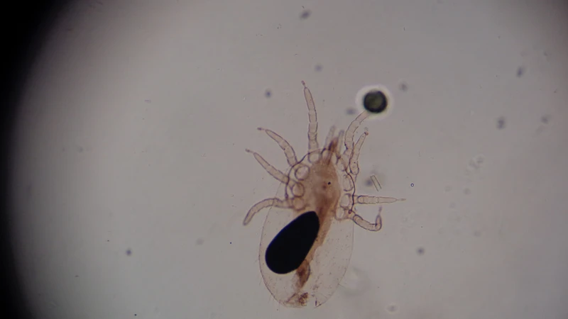 Con cái ghẻ (Sarcoptes scabiei) có kích thước dài khoảng 0,30 - 0,45 mm và rộng 0,25 - 0,35 mm